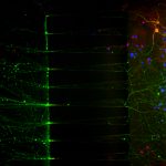 Stained primary neural cells growing through channels